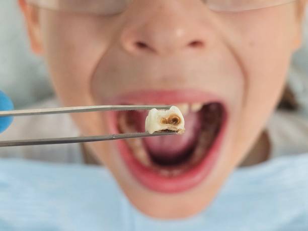 Best Pediatric Emergency Dentist in Apple Valley, UT